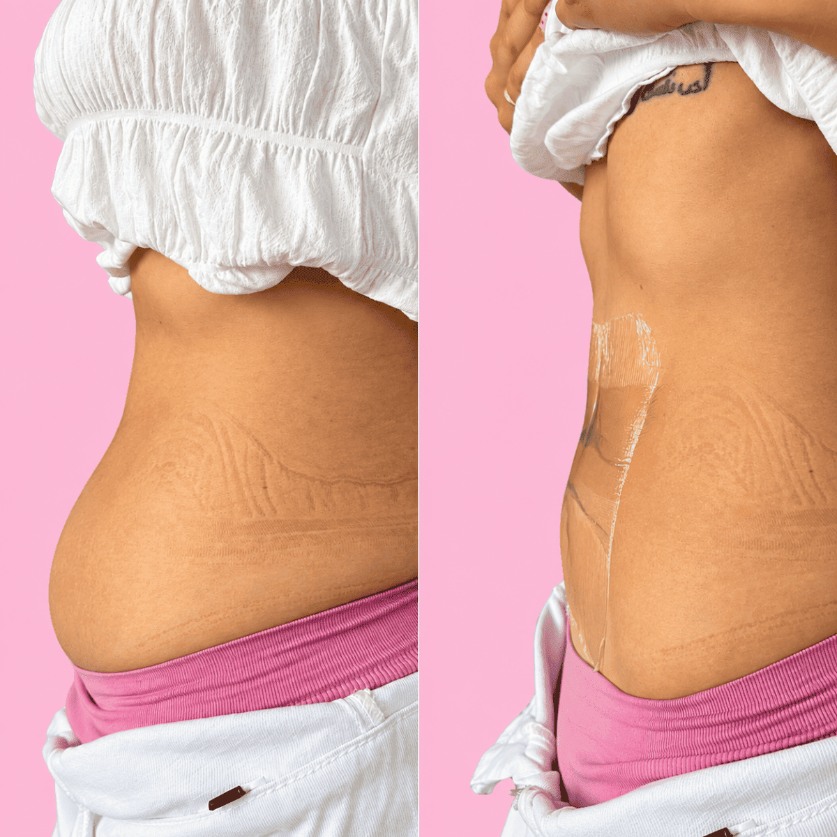 Cinta lifting para el abdomen