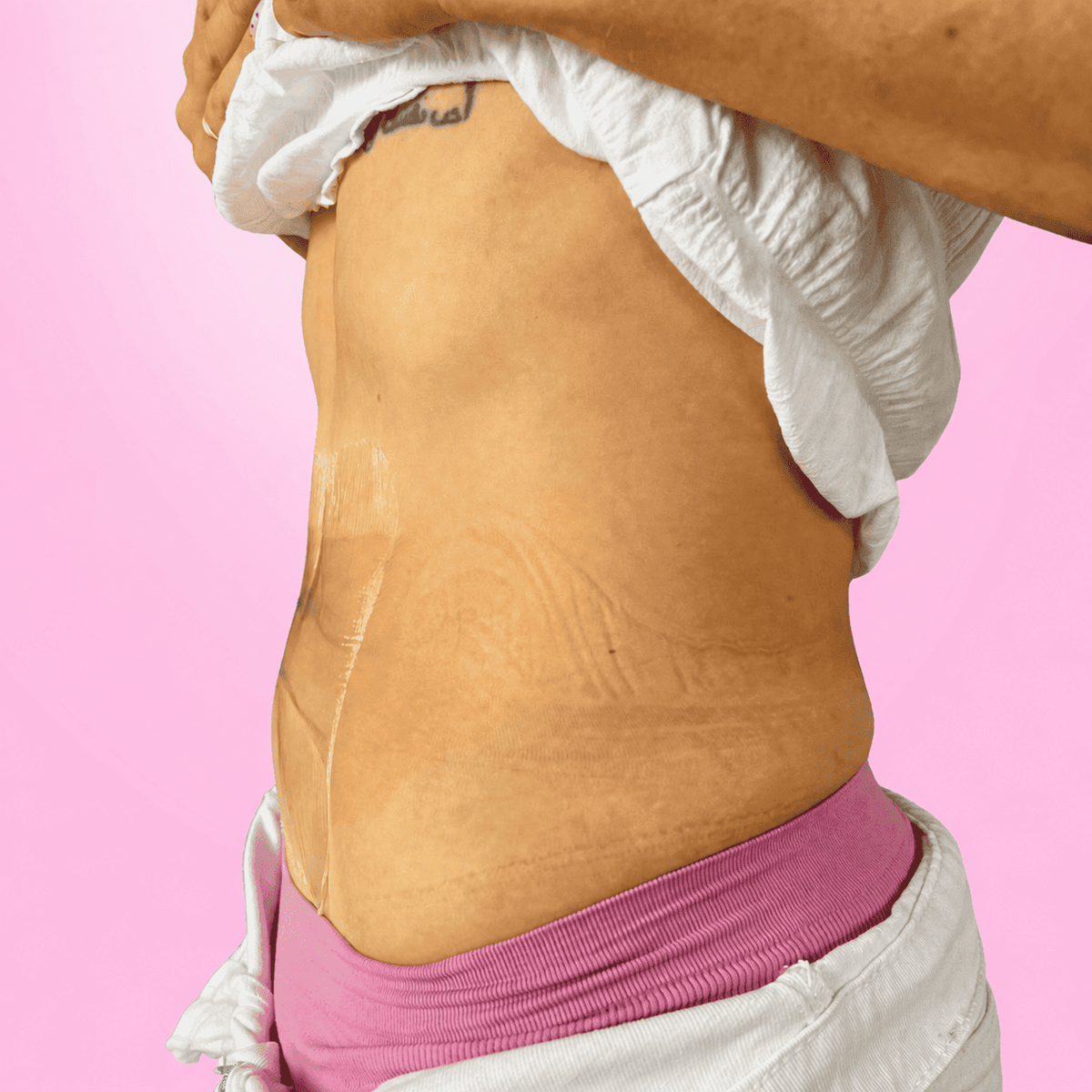 Cinta lifting para el abdomen